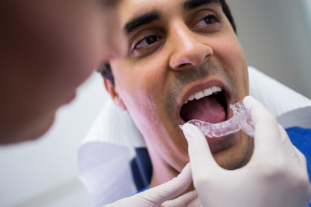 Custom Mouth Guards in Sherman Oaks: Protect Your Smile Day and Night