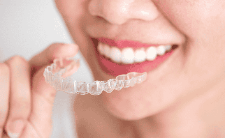 Custom Mouth Guards in Sherman Oaks: Protect Your Smile Day and Night