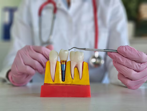 Replacing Missing Teeth: Is A Dental Implant The Best Option for You in Sherman Oaks?