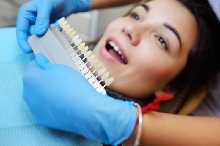 Ultra-thin Porcelain Veneers: The Latest Trend in Sherman Oaks Cosmetic Dentistry