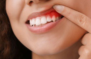 dentist for gum disease