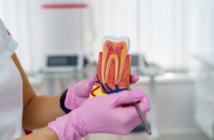 root canal treatments in Sherman Oaks