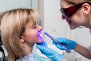 teeth cleaning in Sherman Oaks