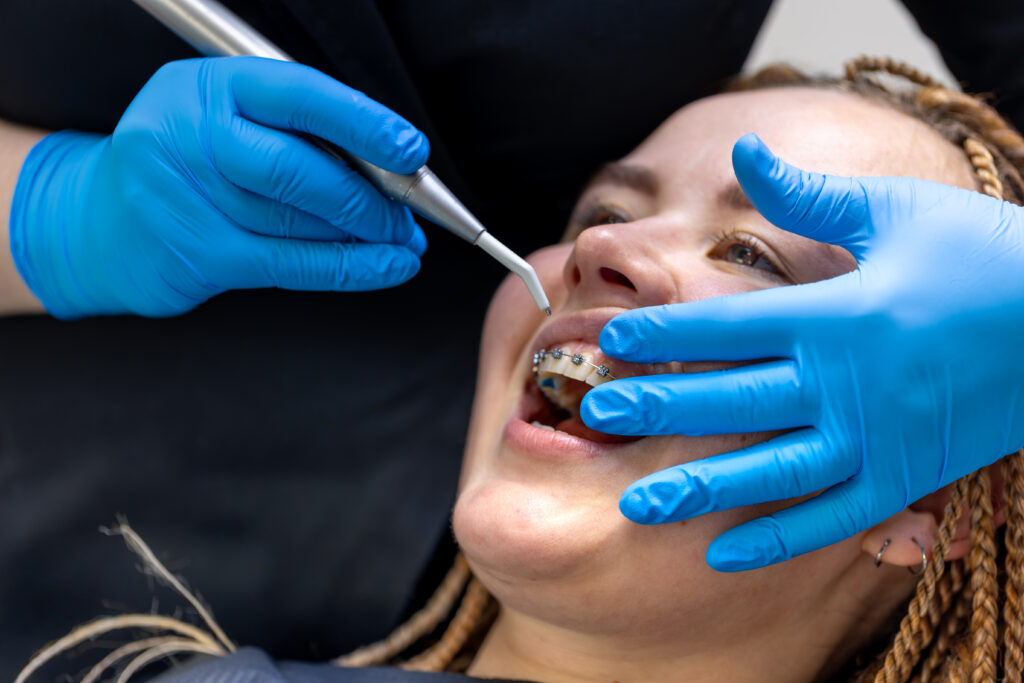 braces orthodontics