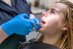 Tooth Extraction
