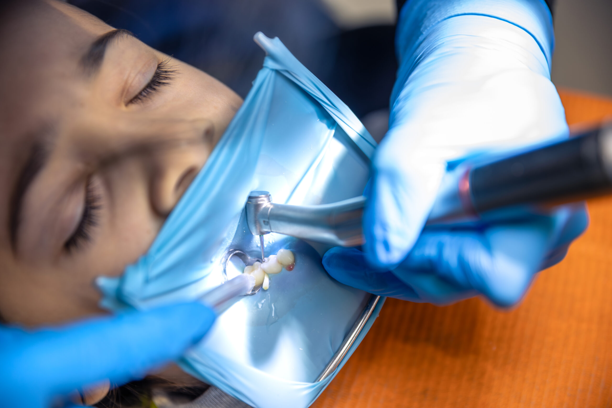 Dental Scaling and Root Planing