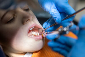 Dental Crown Procedure