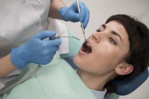 dental fillings