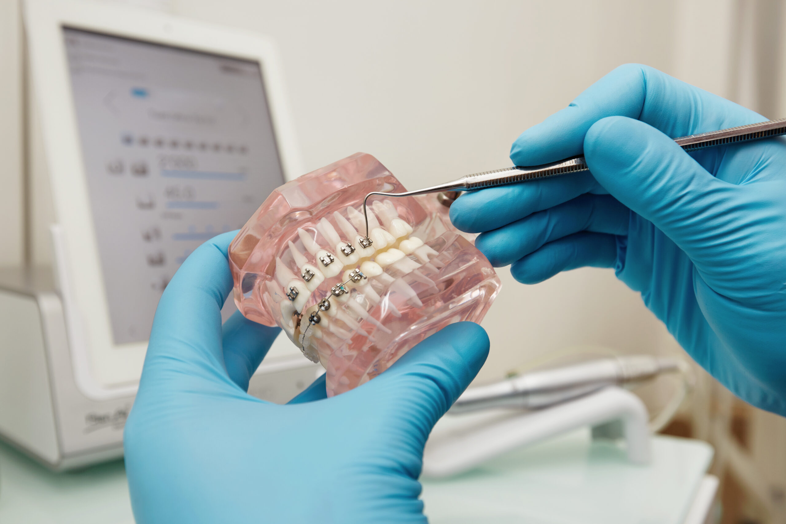 metal braces