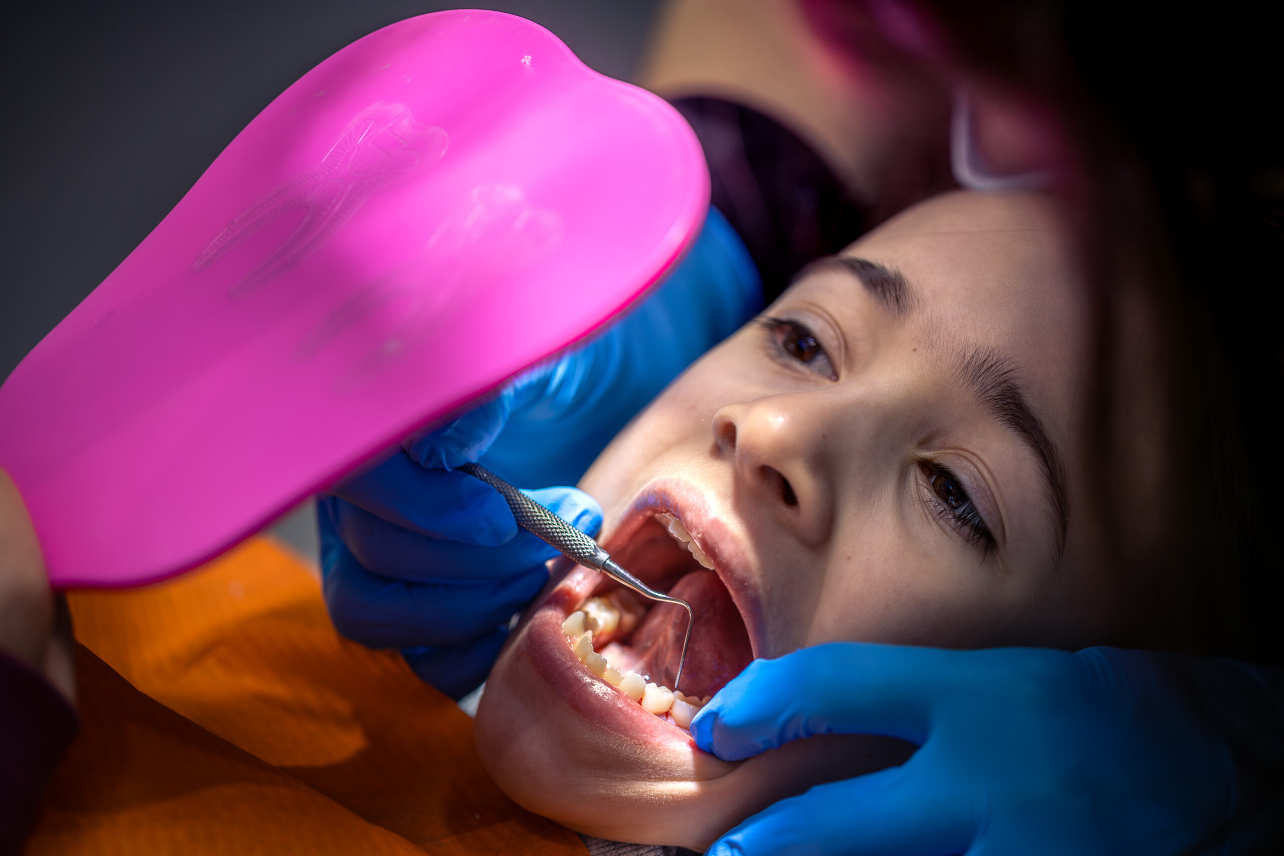 dental sealants