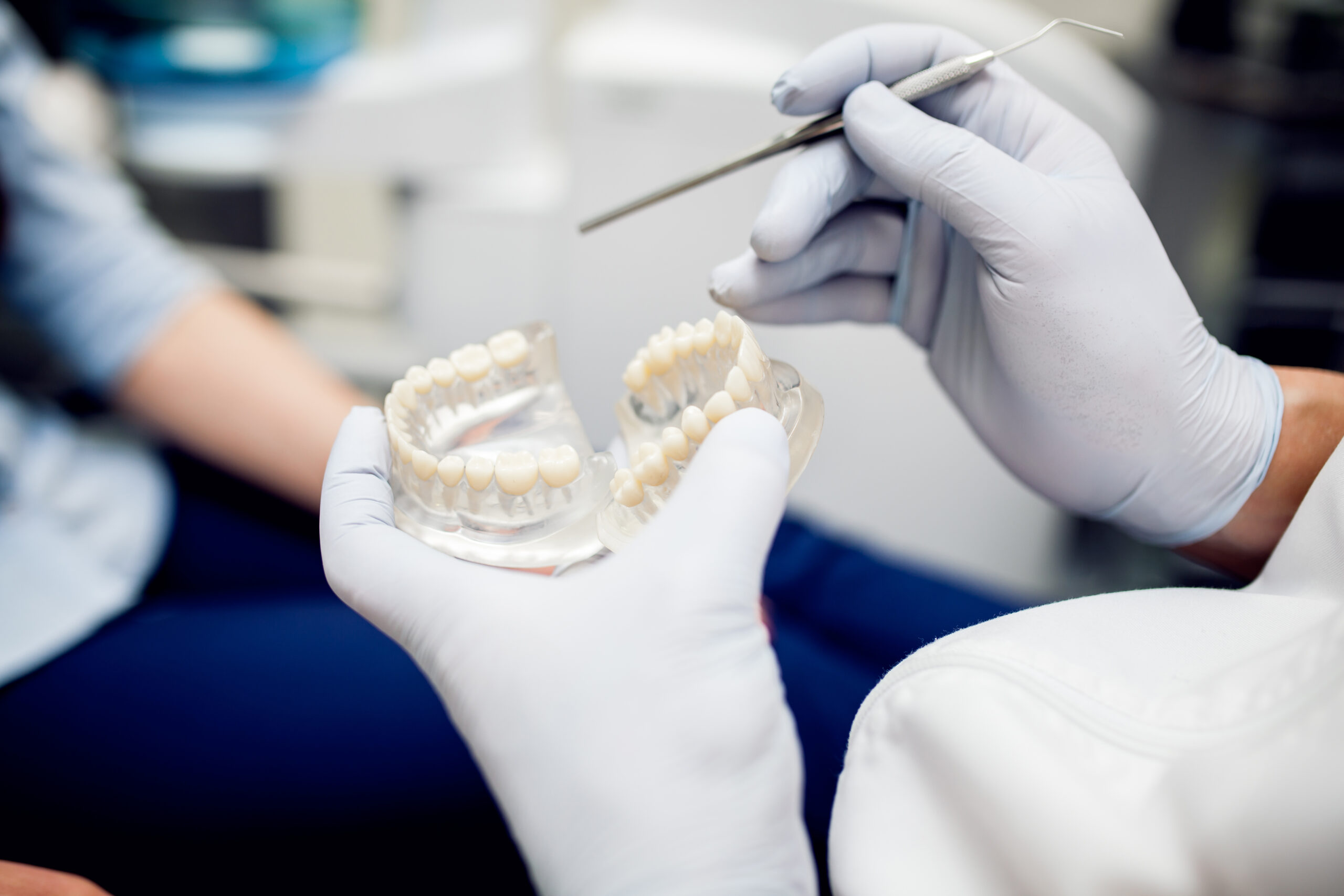 dental bridges