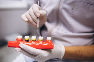 dental crowns