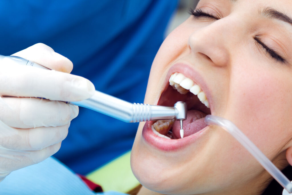 Sherman Oaks tooth extraction
